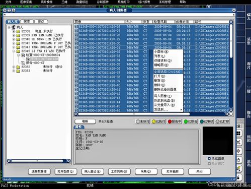 医学影像信息系统(PACS)源码基础解析 架构、原理与数据处理服务